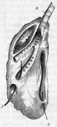 Fig. 327. Lung of Goose (after Owen). a Main bronchus dividing into secondary branches as it enters the lung, these giving off smaller branches, the openings of which are seen on the back of the bronchial tubes: b b Bristles passed from the bronchi through the apertures on the surface of the lung by which the bronchi communicate with the air receptacles.