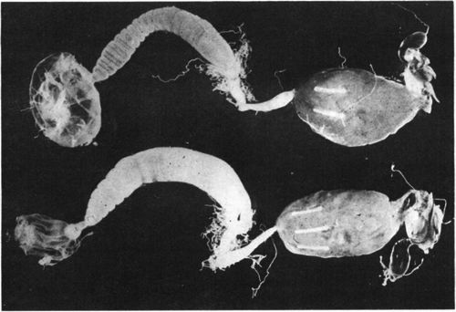 Digestive tract from a healthy bee. Note the individual circular constrictions on the ventriculus. Bottom: Digestive tract of a honey bee with Nosema disease. Note that the circular constrictions on the ventriculus are not clearly defined.