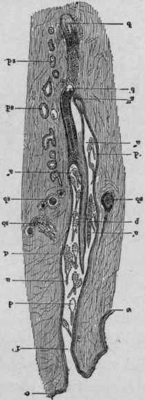 Hair follicle and Sebaceous Glands Affected by Demodex Folliculorum.