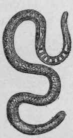 Trichina Spiralis Female