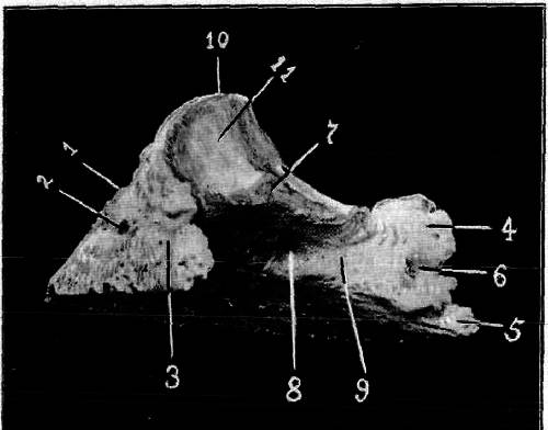 Fig. 4. Third Phalanx Or Os Pedis (Postero Lateral View)