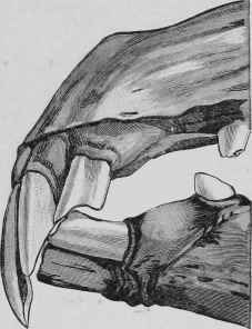 Fig . 127.   Parrot Mouth.
