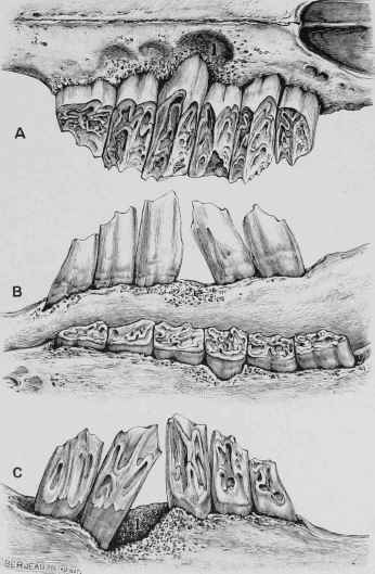 Marginal Irregularities of Teeth.