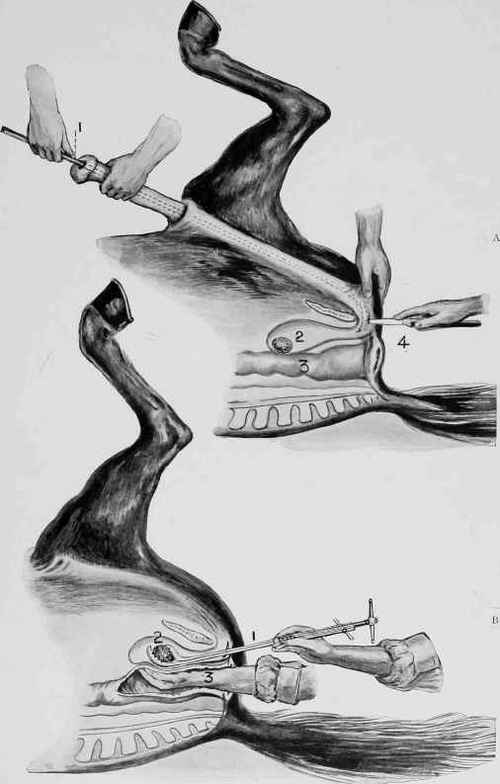 OPERATION FOR STONE.