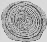 Section of Vesical Calculus.