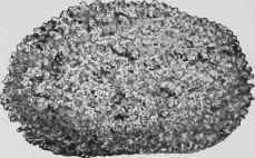 Vesical Calculus.