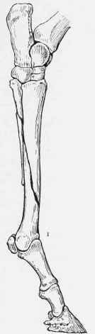 15 Fractures 50075