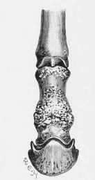 High Ring Bone.