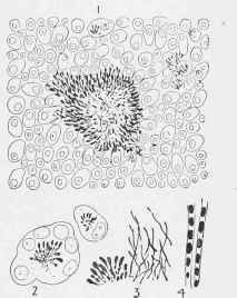 Actinomyces Bovis.