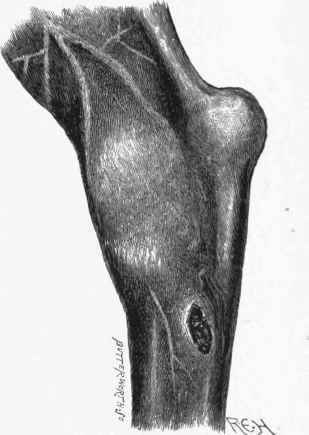 Capped Hock.