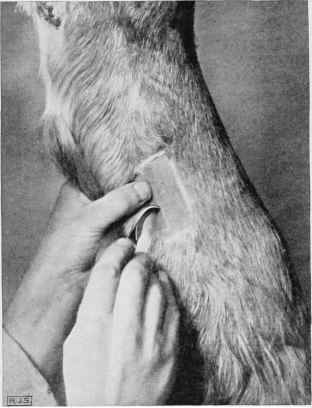Tenotomy of the Perforans Tendon, showing position of hands and knife.
