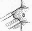 8 Expedients For Throwing Rain Off Walls 10069