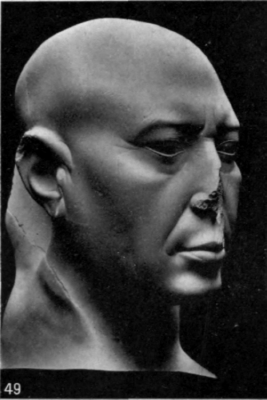 49. Basalt head