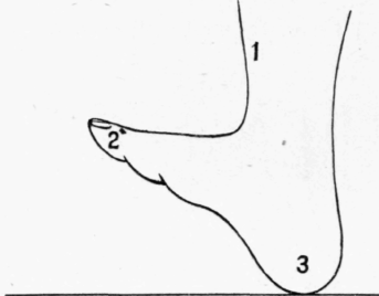 Fig. 32.
