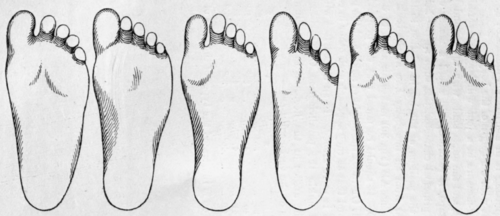 Fig 46 Types Of Soles Of Feet