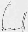 Fig. 35. Gouges marked on design.