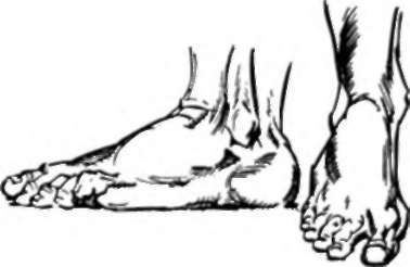 Foot