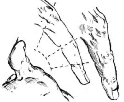 Leg