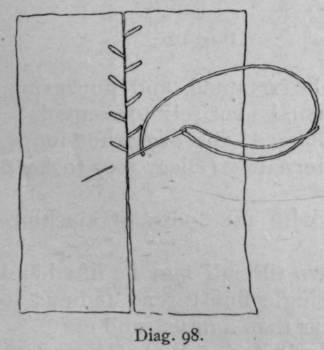 Method 119