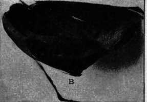 B. Same Burned in Flame.
