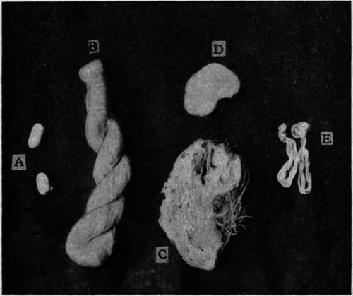 Silk Cocoons and Skeins.
