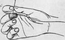 Fig. 2, A.