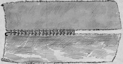 Fig. 25