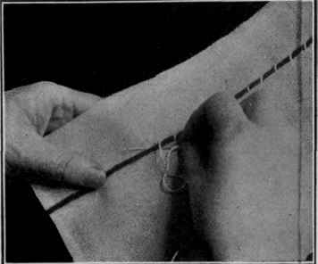Figure 30.