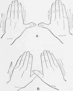 Manner of Crossing the Thumbs to Receive the Double Tie of the Cord