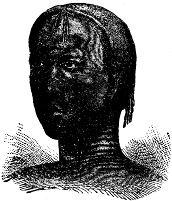III The Head And Face 392 12f