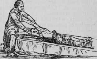 Treatment After Natural Breathing Has Been Restore 154