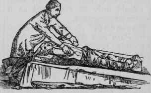 Treatment After Natural Breathing Has Been Restore 155