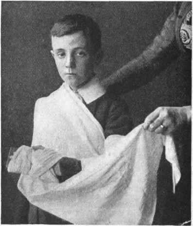 Fig. 3. Splints and broad sling for a broken forearm