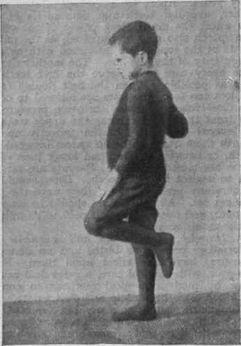 An excellent exercise for weak ankles and undeveloped calves is to hop round the room on each foot alternately