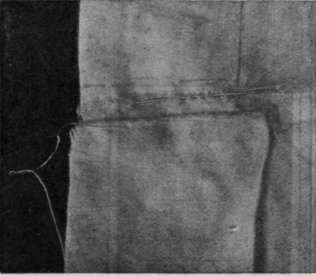 Fig. 6. The material inserted into the hem and the frayed edges neatly darned down