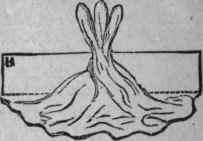 The Colonne De Triomphe 141