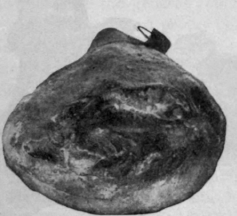 Inferior Ham.