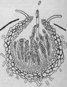 Perithecium of apple scab, showing spores.