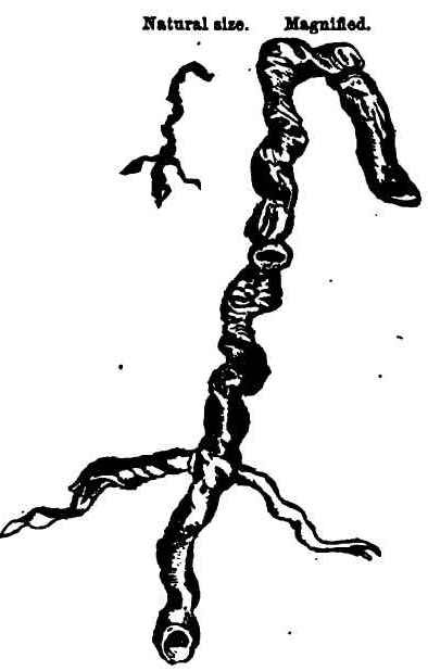 Entozoa from the trachea of a young chicken.