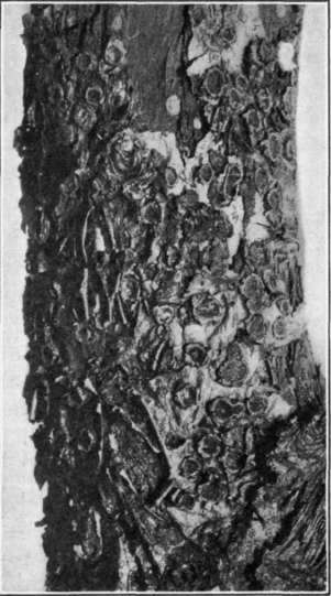 Fig. 22. Blister Canker of apple. Old canker, showing