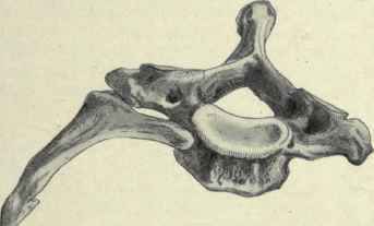 Fig. 198. A cervical rib attached to the right side of the seventh cervical vertebra.