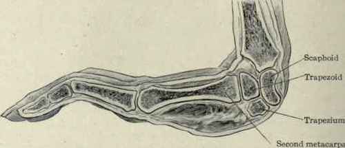 Fig. 344. Position assumed by the carpal bones in extension of the wrist.