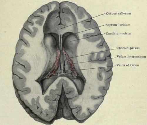 Fig. 36. Horizontal section of brain; the corpus callosum and fornix have been removed, exposing the lateral ventricles, with the caudate nuclei projecting into them anteriorly and the velum interpositum farther back, with the choroid plexus at the sides and the veins of Galen nearer the middle line. The lateral ventricles in this brain are somewhat larger than usual.