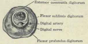 Fig. 383. A transverse section of the proximal phalanx.