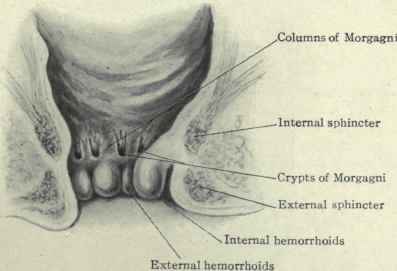 Fig. 448.   Hemorrhoids.