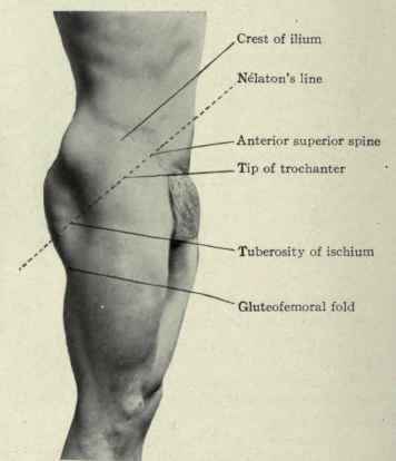 Fig. 506. Surface anatomy of the region of the hip.