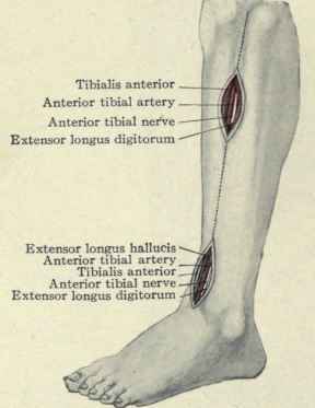 Fig. 561. Ligation of the anterior tibial artery in its upper and lower thirds.