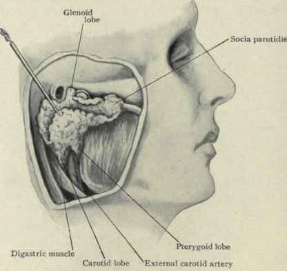 Fig. 61. The lobes of the parotid gland.