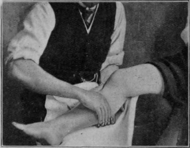 Fig. 10. Kneading. Second position. Note the relative pronation. The rotation is exaggerated for purposes of reproduction