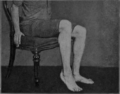 Fig. 107. Second stage of the first sitting exercise. The heel is raised and lowered